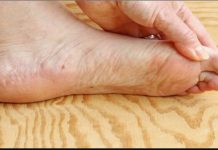 7 znakova da se tijelo već duže vrijeme bori s VISOKIM ŠEĆEROM U KRVI: Prvo ćete to primijetiti na očima i nogama!