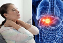 Nije joj palo na pamet daovi simptomi signaliziraju bolest jetre: OVO je 13 simptoma čije vam rano liječenje može spasiti život!