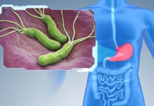 Ovo Povrće Ubija Heliko Bakteriju, Sprečava Kiselinu I Karcinom Želuca: Dovoljno Je Jesti 70 Grama Dnevno!