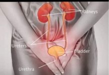 Savjet ljekara: Šta učiniti kada patite od učestalog mokrenja, bolnog mokrenja i hitnosti