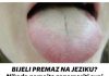 BIJELI PREMAZ NA JEZIKU? Nikada nemojte zanemariti ovaj simptom – 2važna organa mogu biti oslabljena…