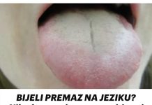 BIJELI PREMAZ NA JEZIKU? Nikada nemojte zanemariti ovaj simptom – 2važna organa mogu biti oslabljena…