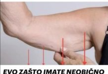 EVO ZAŠTO IMATE NEOBIČNO OBJEŠENU KOŽU- Većina ljudi nemapojma o ovom problemu. Jedino efikasno rješenje je ovaj domaći trik