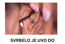 SVRBELO JE UVO DO BESVESTI, OTIŠLA DOKTORU, A TAMO ŠOK: Kada su videli šta je unutra nisu mogli da veruju! (FOTO)