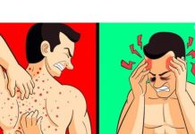 TIJELO VAM ŠALJE UPOZORENJE: Ovo je 12 znakova da jedete previše šećera SHVATITE OZBILJNO! Broj 5 nikako ne zanemarujte!