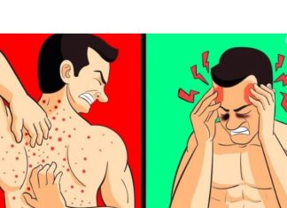 TIJELO VAM ŠALJE UPOZORENJE: Ovo je 12 znakova da jedete previše šećera SHVATITE OZBILJNO! Broj 5 nikako ne zanemarujte!