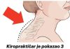 Kiropraktičar je pokazao 3 jednostavne vježbe kako da uklonite “Grbu” u vratu: 0vo mi je najviše pomoglo! (VIDEO)