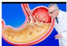 OVO JEDITE ZA VEČERU 3 DANA ZAREDOM: Nećete vjerovati šta će SVE izaći iz vašeg stomaka! (FOTO)