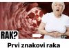 Ovo su prvi znakovi raka debelog crijeva koje žene ignoriraju- Na vrijeme saznajte! (FOTO)