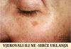 VJEROVALI ILI NE – SIRĆE UKLANJA BORE AKNE I STARAČKE PjEGE! Ovako se koristi!