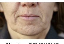 Simptom DEMENCIJE koji se prvo javlja u ustima: Ako ga osjetite, obratite se ljekaru!