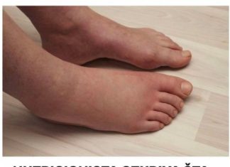 EVO ŠTA TREBA DA RADITE AKO VAŠE TIJELO ZADRŽAVA VODU: Sve što vam treba imate u kuhinji samo uzmite i… (FOTO)