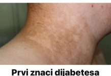 Evo koji su prvi znakovi dijabetesa koji ljudi često ignorišu godinama!