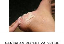 GENIJALAN TRIK ZA GRUBE RUKE, ISPUCALE PETE, KURJE OČI I KRIVE NOKTE NA NOGAMA: Odmah zapišite, nećete se pokajati