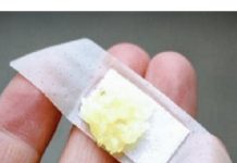 Razlog će vas iznenaditi: Komad bijelog luka stavite na flaster i zalijepite na kožu- OD SADA ĆETE SVAKI DAN TO RADITI…