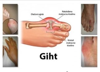 UZ POMOĆ OVOGA IZBACITE M0KRAĆNU KISELINU IZ TIJELA: Prirodni napitak za liječenje GIHTA (RECEPT)
