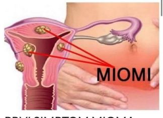 PRVI SIMPTOM MIOMA MATERICE: Žene ako ovo uočite – ODMAH kod ginekologa!