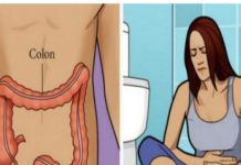 Ovo su 4 glavna simptoma RAKA DEBELOG CRIJEVA koje ljudi zanemaruju dugi niz godina! Evo kako ćete ih prepoznati….
