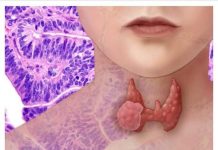 Imate li problem sa štitnom žlijezdom, ove 2 namirnice ODMAH izbacite: Štitna žlijezda ih MRZI!