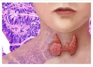 Imate li problem sa štitnom žlijezdom, ove 2 namirnice ODMAH izbacite: Štitna žlijezda ih MRZI!