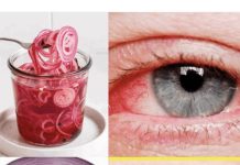 Koristite luk za poboljšanje vida samo 5 dana i evo šta će se desiti! ( RECEPT i UPUTSTVO )