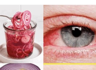 Koristite luk za poboljšanje vida samo 5 dana i evo šta će se desiti! ( RECEPT i UPUTSTVO )