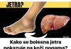 Evo kako se bolesna jetra pokazuje na koži,nogama? OVO SU PRVI SIMPTOMI BOLESNE JETRE… (FOTO)