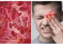 OVO SU SIMPTOMI NISKOG ŽELJEZA U KRVI: Tijelo vas upozorava 1 SIMPTOMOM: Reagujte na vrijeme!